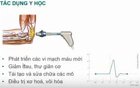 t&aacute;c dụng của s&oacute;ng xung k&iacute;ch