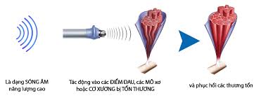 t&aacute;c dụng của s&oacute;ng xung k&iacute;ch 